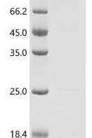 Human Dehydrogenase/reductase SDR family member 4 (DHRS4), partial Recombinant Protein - BioCrest Sci