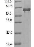 Cenarchaeum symbiosum DNA polymerase II large subunit (polC), partial Recombinant Protein - BioCrest Sci