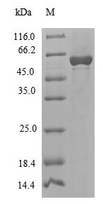 Cenarchaeum symbiosum DNA polymerase II large subunit (polC), partial Recombinant Protein, Cenarchaeum symbiosum (strain A), E.coli, Tag-Free, 59.0 kDa, purity >≥ 90% as determined by SDS-PAGE.
