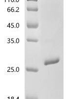 Human Neuronal acetylcholine receptor subunit alpha-7 (CHRNA7), partial Recombinant Protein, N-His-Avi - BioCrest Sci