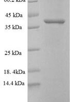 Mouse Proprotein convertase subtilisin/kexin type 5 (Pcsk5), partial Recombinant Protein - BioCrest Sci