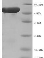 Staphylococcus aureus Replication initiation protein (repD) Recombinant Protein - BioCrest Sci