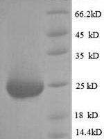 Rat Fibroblast growth factor 23 (Fgf23) Recombinant Protein, N-His, aa 25–251, Yeast - BioCrest Sci
