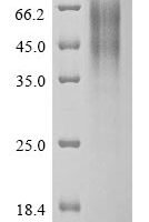 Human betacoronavirus 2c EMC/2012 Spike glycoprotein (S), partial Recombinant Protein, N-His - BioCrest Sci