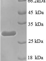 Human Transcription termination factor 1 (TTF1), partial Recombinant Protein - BioCrest Sci