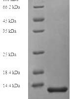 Human CD81 antigen (CD81), partial Recombinant Protein, N-His - BioCrest Sci