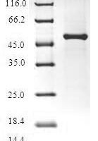 Human Fibroblast growth factor 14 (FGF14) Recombinant Protein, N-GST - BioCrest Sci