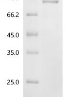 Rat Heat shock protein HSP 90-alpha (Hsp90aa1) Recombinant Protein, N-10His/C-Myc - BioCrest Sci