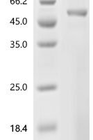 Human Keratin, type I cuticular Ha5 (KRT35) Recombinant Protein - BioCrest Sci