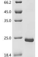 Human papillomavirus 30 Protein E7 (E7) Recombinant Protein - BioCrest Sci