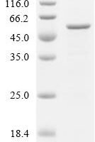 Human Stromelysin-1 (MMP3) Recombinant Protein - BioCrest Sci