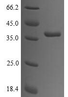 Rabbit Tropomyosin alpha-1 chain (TPM1) Recombinant Protein - BioCrest Sci