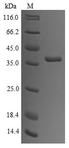 Rabbit Tropomyosin alpha-1 chain (TPM1) Recombinant Protein, Oryctolagus cuniculus (Rabbit), Yeast, N-terminal 6xHis-tagged and C-terminal Myc-tagged, 36.2 kDa, purity >≥ 85% as determined by SDS-PAGE.