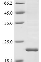 Bovine coronavirus Non-structural protein of 4.9 kDa (4a) Recombinant Protein, N-His-SUMO - BioCrest Sci