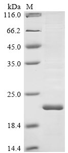 Bovine coronavirus Non-structural protein of 4.9 kDa (4a) Recombinant Protein, N-His-SUMO, Bovine coronavirus (strain LY-138) (BCoV) (BCV), E.coli, N-terminal 6xHis-SUMO-tagged, 18.0 kDa, purity >≥ 85% as determined by SDS-PAGE.