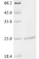 Haemophilus influenzae Peptidoglycan-associated lipoprotein (pal) Recombinant Protein - BioCrest Sci