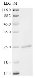 Haemophilus influenzae Peptidoglycan-associated lipoprotein (pal) Recombinant Protein, Haemophilus influenzae (strain ATCC 51907 / DSM 11121 / KW20 / Rd), E.coli, C-terminal 6xHis-tagged, 21.1 kDa, purity >≥ 85% as determined by SDS-PAGE.