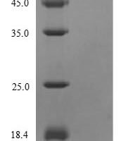 Influenza A virus Matrix protein 2 (M), partial Recombinant Protein, N-His - BioCrest Sci