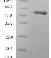 Human Phosphoserine phosphatase (PSPH) Recombinant Protein - BioCrest Sci