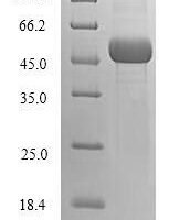 Human Ubiquitin-conjugating enzyme E2 Q2 (UBE2Q2) Recombinant Protein - BioCrest Sci