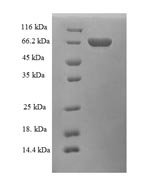 Human Alcohol dehydrogenase class-3 (ADH5) Recombinant Protein, N-GST - BioCrest Sci