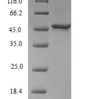 Human Ras-related protein Rab-31 (RAB31) Recombinant Protein - BioCrest Sci