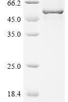 Dog Angiopoietin-1 (ANGPT1) Recombinant Protein, C-His, aa 20–497, E.coli - BioCrest Sci