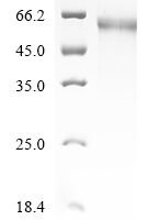 Human Thyrotropin receptor (TSHR), partial Recombinant Protein, C-10His - BioCrest Sci