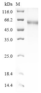 Human Thyrotropin receptor (TSHR), partial Recombinant Protein, C-10His, Homo sapiens (Human), Baculovirus, C-terminal 10xHis-tagged, 48.7 kDa, purity >≥ 85% as determined by SDS-PAGE.