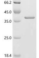 Mouse Syntaxin-17 (Stx17), partial Recombinant Protein - BioCrest Sci