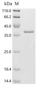 Mouse Syntaxin-17 (Stx17), partial Recombinant Protein, Mus musculus (Mouse), E.coli, C-terminal 6xHis-tagged, 32.7 kDa, purity >≥ 90% as determined by SDS-PAGE.