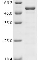 Mouse E3 ubiquitin-protein ligase TRIM21 (Trim21) Recombinant Protein - BioCrest Sci