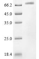 Coxiella burnetii Hypothetical membrane spanning protein (CBU_1863), partial Recombinant Protein, N-GST - BioCrest Sci