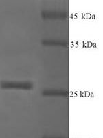Arachis hypogaea Arachin Ahy-3, partial Recombinant Protein - BioCrest Sci