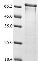 Human Isthmin-2 (ISM2) Recombinant Protein - BioCrest Sci