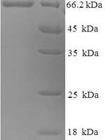 Canine distemper virus Fusion glycoprotein F0 (F), partial Recombinant Protein - BioCrest Sci