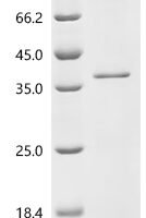 Human CCN family member 5 (CCN5) Recombinant Protein, C-10His - BioCrest Sci
