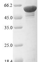 Human Prolyl 4-hydroxylase subunit alpha-1 (P4HA1) Recombinant Protein - BioCrest Sci