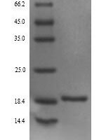 Platanus acerifolia Putative invertase inhibitor Recombinant Protein, N-His - BioCrest Sci