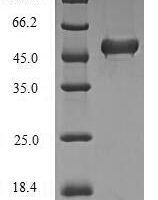 Human Lys-63-specific deubiquitinase BRCC36 (BRCC3) Recombinant Protein, N-His-SUMO - BioCrest Sci