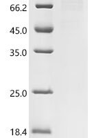 Klebsiella pneumoniae subsp. pneumoniae Penicillin-binding protein 1B, partial Recombinant Protein, C-10His - BioCrest Sci