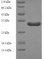 Bacillus subtilis Probable flavodoxin-2 (ykuP) Recombinant Protein - BioCrest Sci