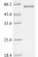 Mouse Neurotrimin (Ntm) Recombinant Protein - BioCrest Sci