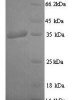 Epstein-Barr virus Latent membrane protein 1 (LMP1), partial Recombinant Protein, N-His - BioCrest Sci