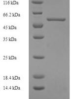 Human CYFIP-related Rac1 interactor B (CYRIB) Recombinant Protein - BioCrest Sci