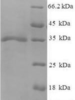 Human cytomegalovirus (strain AD169) (HHV-5) Envelope glycoprotein H (gH), partial Recombinant Protein - BioCrest Sci