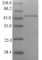 Human Carbonyl reductase family member 4 (CBR4) Recombinant Protein - BioCrest Sci