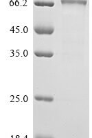Human Interleukin-12 receptor subunit beta-1 (IL12RB1), partial Recombinant Protein, C-His - BioCrest Sci