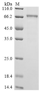 Human Interleukin-12 receptor subunit beta-1 (IL12RB1), partial Recombinant Protein, C-His, Homo sapiens (Human), Baculovirus, C-terminal 6xHis-tagged, 60.4 kDa, purity >≥ 85% as determined by SDS-PAGE.
