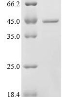 Human Alanine--tRNA ligase, mitochondrial (AARS2), partial Recombinant Protein, C-His, aa 450–750 - BioCrest Sci